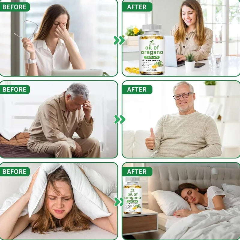 Yimiduk Oregano Oil Extract Softgels - Powerful Herbal Supplement for Immune, Respiratory & Digestive System Support
